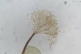 Attēlu rezultāti vaicājumam “Clastoderma debaryanum macro”