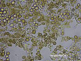 Attēlu rezultāti vaicājumam “Chaenotheca trichialis”