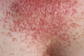 Image result for Lewandowsky-Lutz