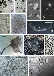 Attēlu rezultāti vaicājumam “Lamproderma ovoideum spores”