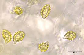 Attēlu rezultāti vaicājumam “Physarum viride var. aurantium spores”