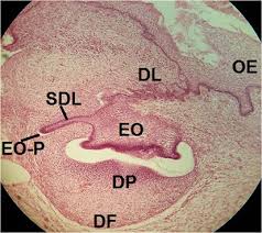 Attēlu rezultāti vaicājumam “Odontoschisma denudatum cells”