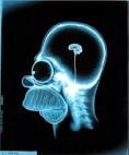 x-rays