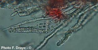 Attēlu rezultāti vaicājumam “Aleurodiscus amorphus”