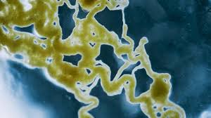 Attēlu rezultāti vaicājumam “Reticularia jurana young”