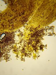 Attēlu rezultāti vaicājumam “Physarum nitens spores”
