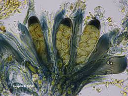 Attēlu rezultāti vaicājumam “Lecidella elaeochroma”