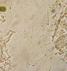 Attēlu rezultāti vaicājumam “Hyalorbilia inflatula”