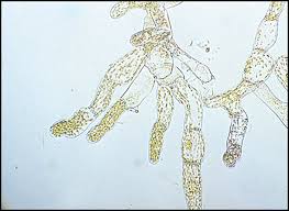 Attēlu rezultāti vaicājumam “Splachnum ampullaceum sporophyte”