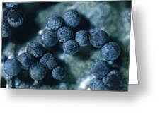 Attēlu rezultāti vaicājumam “Diachea sp.”