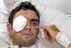 Marcel Wüst in der Klinik: Die Ärzte konnten sein rechtes Auge nicht retten