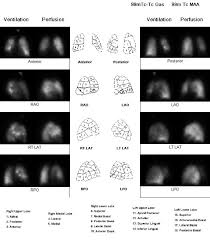 Image result for  v    q