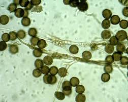 Attēlu rezultāti vaicājumam “Didymium tussilaginis sessile”