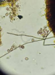 Attēlu rezultāti vaicājumam “Symphytocarpus trechisporus sessile”