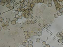 Attēlu rezultāti vaicājumam “Dianema nivale”