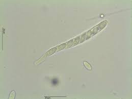 Attēlu rezultāti vaicājumam “Hymenoscyphus imberbis”