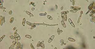 Attēlu rezultāti vaicājumam “Licea pusilla spores”