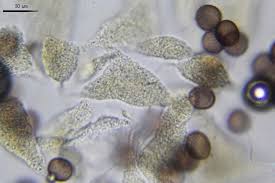 Attēlu rezultāti vaicājumam “Physarum bryocorticola macro”