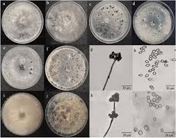 Attēlu rezultāti vaicājumam “Trichia botrytis var. cerifera spores”