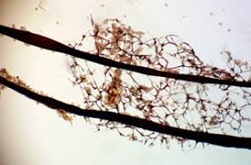 Attēlu rezultāti vaicājumam “Symphytocarpus flaccidus stalked”