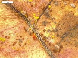 Attēlu rezultāti vaicājumam “Heterotrichia oerstedii (syn. Arcyria oerstedii) spores”