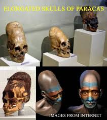 Image result for elongated skulls