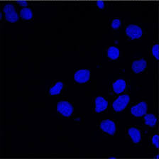 Attēlu rezultāti vaicājumam “Physarum obscurum sessile”