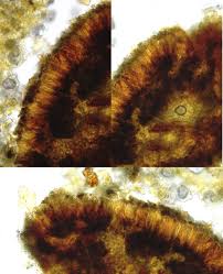 Attēlu rezultāti vaicājumam “Arthonia leucopellaea”