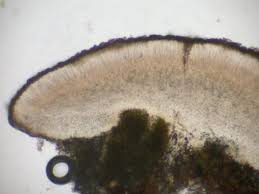 Attēlu rezultāti vaicājumam “Cliostomum corrugatum”