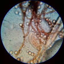 Attēlu rezultāti vaicājumam “Arcyria affinis”