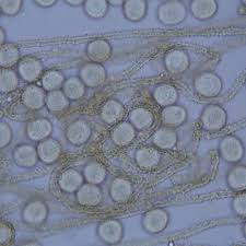 Attēlu rezultāti vaicājumam “Badhamia affinis var. microspora spores”
