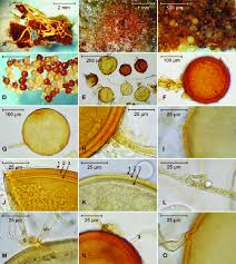 Attēlu rezultāti vaicājumam “Stemonitopsis aequalis var. microspora spores”