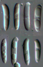 Attēlu rezultāti vaicājumam “Hymenoscyphus imberbis”