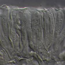 Attēlu rezultāti vaicājumam “Hyalorbilia inflatula”