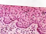 Stratified Squamous <b>Epithelium</b>