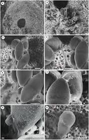 Attēlu rezultāti vaicājumam “Lasiosphaeria ovina spores”