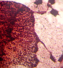 Attēlu rezultāti vaicājumam “Cribraria rubiginosa spores”