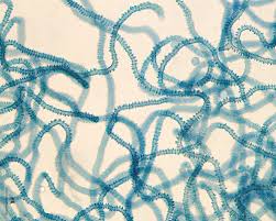 Attēlu rezultāti vaicājumam “Arcyria affinis spores”