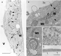 Attēlu rezultāti vaicājumam “Odontoschisma denudatum cells”