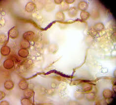 Attēlu rezultāti vaicājumam “Didymium proximum macro”