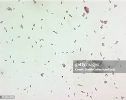 Attēlu rezultāti vaicājumam “Lycogala botrydium spores”