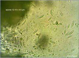 Attēlu rezultāti vaicājumam “Micarea sp.”