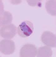 Attēlu rezultāti vaicājumam “Diderma radiatum plasmodium”