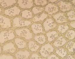 Attēlu rezultāti vaicājumam “Calypogeia sphagnicola”