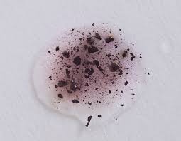 Attēlu rezultāti vaicājumam “Hypoxylon vogesiacum”