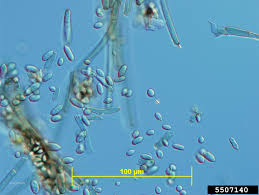 Attēlu rezultāti vaicājumam “Colloderma robustum spores”