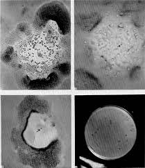 Attēlu rezultāti vaicājumam “Didymium nigripes spores”