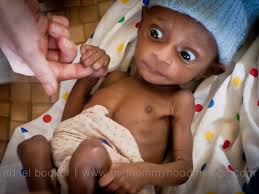 Attēlu rezultāti vaicājumam “Diderma umbilicatum young”