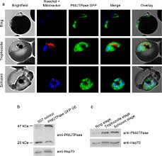 Attēlu rezultāti vaicājumam “Diachea muscorum plasmodium”