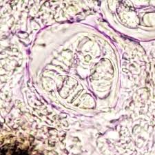 Attēlu rezultāti vaicājumam “Arthonia leucopellaea”